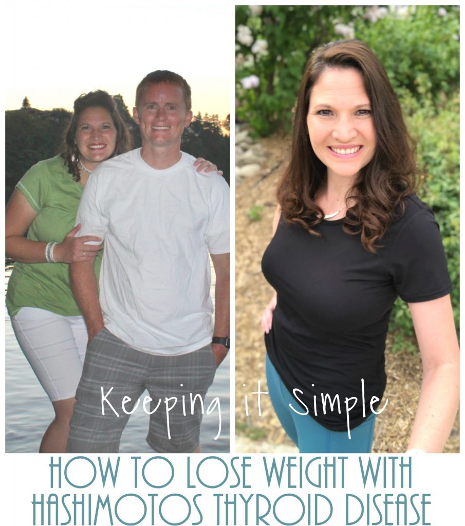 How To Lose Weight With Hashimotos Thyroid Disease My Journey To A Healthy Lifestyle Keeping It Simple